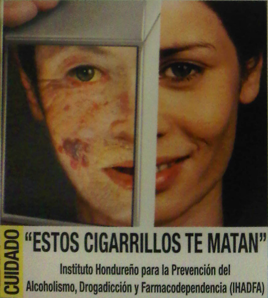 Honduras 2011 Health Effect Wrinkles - lived experience, gross, skin, aging